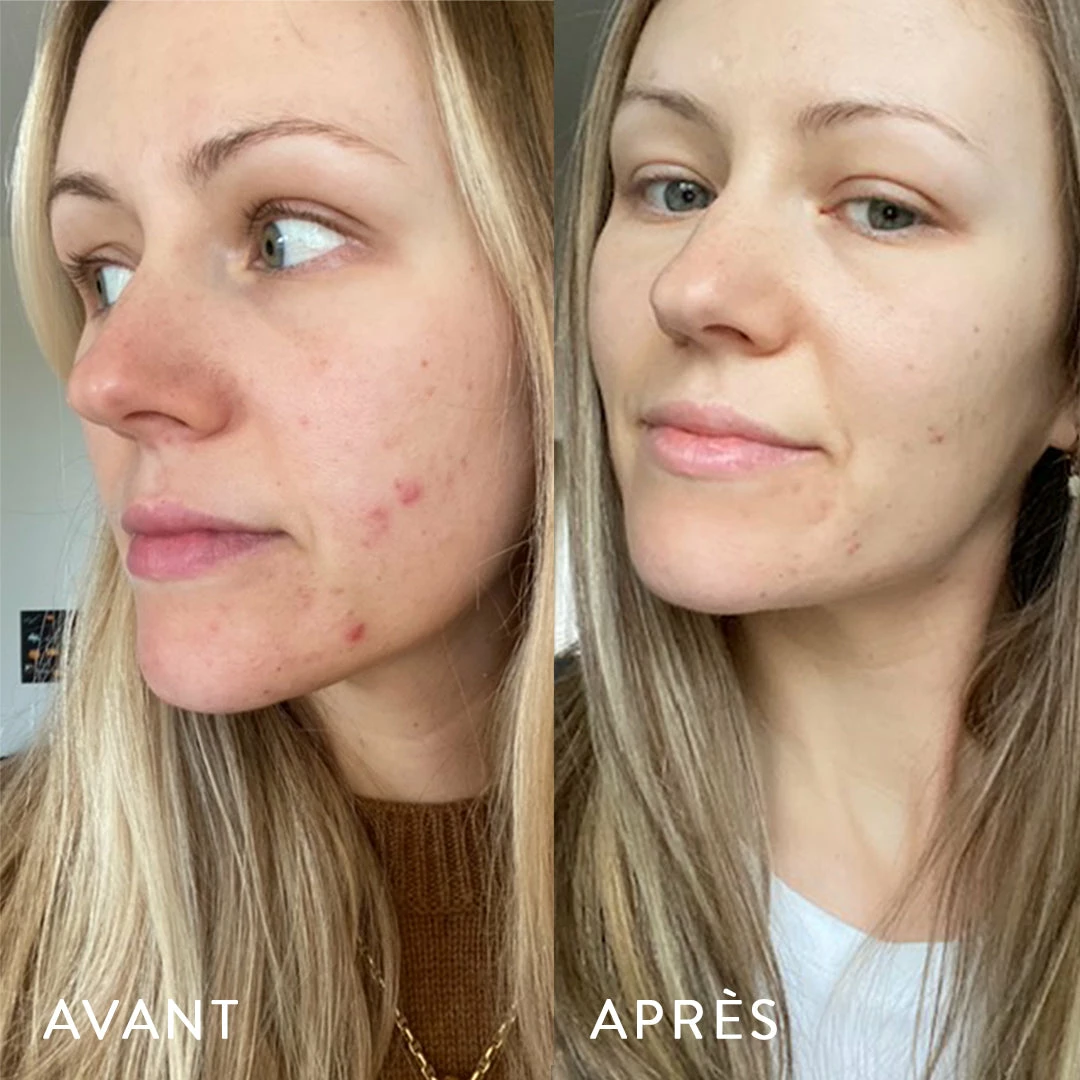 Microbiote & Peau – Image 4