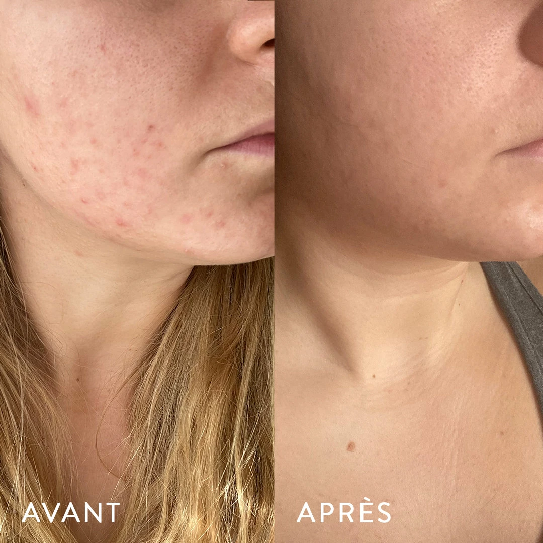 Microbiote & Peau – Image 3